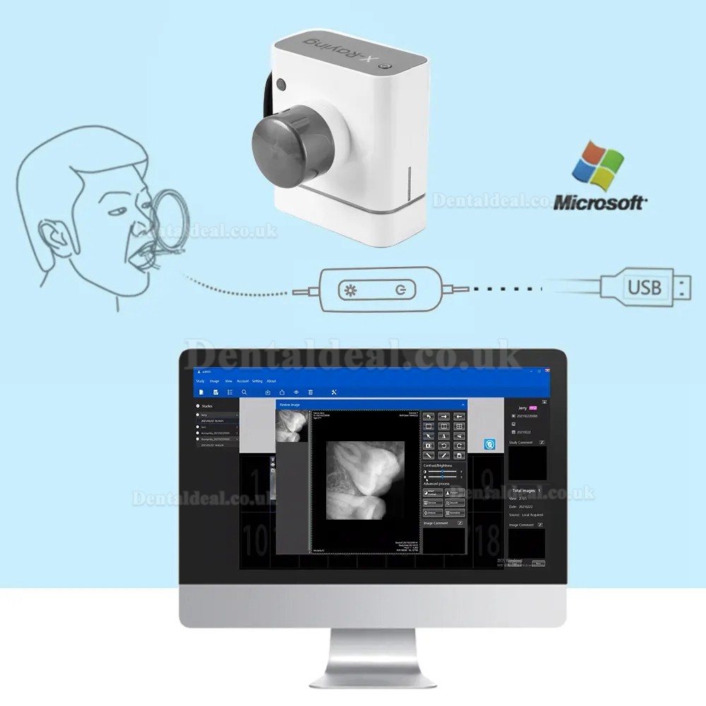 Dental Digital X-Ray Sensor RVG Dental Intraoral Imaging System